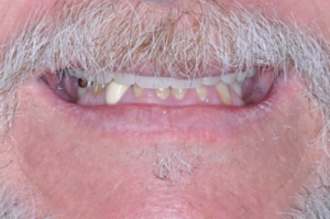Case Scenario 2 - Before
