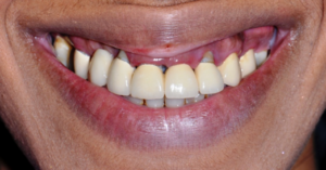 Case Scenario 3 - Before